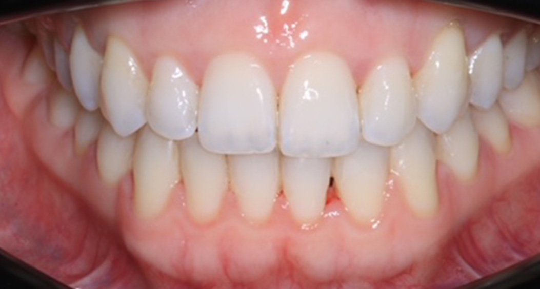 orthodontics portadown